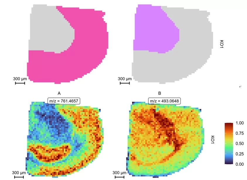Co-localization analysis of regions of interest